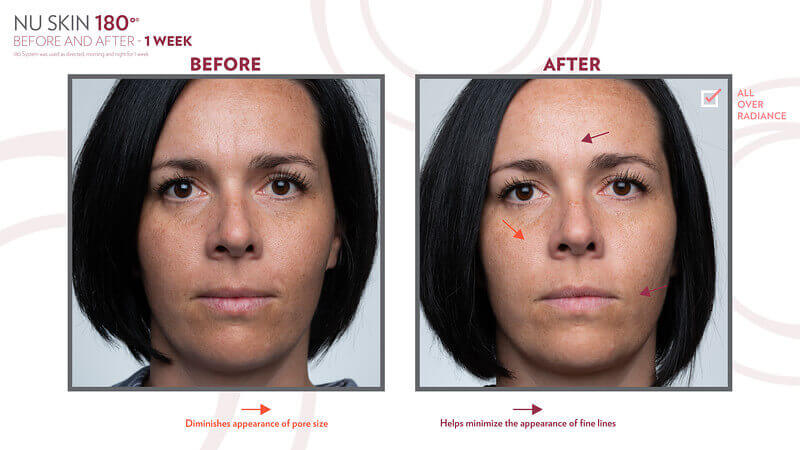 Nu-Skin-180-Anti-Ageing-Skin-Therapy-System-Before-and-After-Picture
