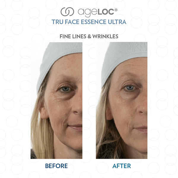 Nu-Skin-ageLOC-Tru-Face-Essence-Ultra-Before-and-After-Picture-1