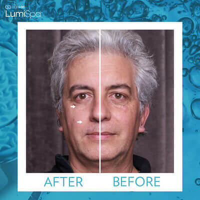 Nu-Skin-ageLOC-LumiSpa-Before-and-After-Picture-2