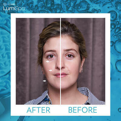 Nu-Skin-ageLOC-LumiSpa-Before-and-After-Picture