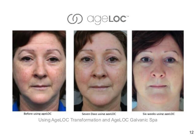 Nu-Skin-ageLOC-Transformation-Before-and-After-Picture-2