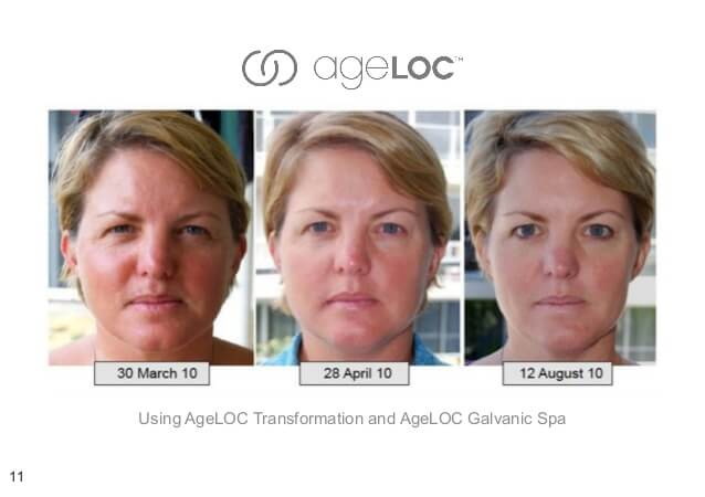 Nu-Skin-ageLOC-Transformation-Before-and-After-Picture