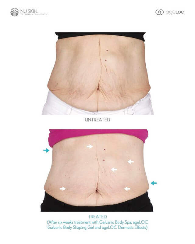 ageLOC-Galvanic-Body-Spa-Before-and-After