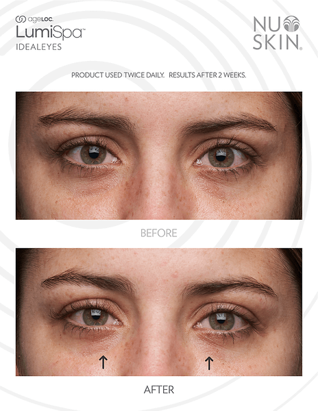 ageLOC-LumiSpa-Accent-y-IdealEyes-Before-and-After-Picture-2
