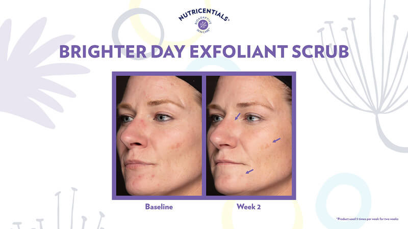 Nu-Skin-Nutricentials-Brighter-Day-Exfoliant-Scrub-Before-and-After-Picture