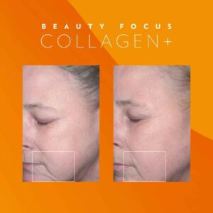 beauty-focus-collagen-foto-antes-y-despues-resultados-clinicos