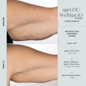 ageloc-wellspa-io-before-and-after-arm
