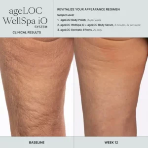 ageloc-wellspa-io-before-and-after-leg